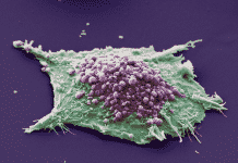 Featured at AACR Annual Meeting: VisionGate Lung Cancer 3D Imaging Research
