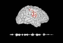 Brain Implant Device: People Can Communicate With Their Minds