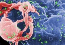 Natural Immunity to HIV Could Lead to HIV Vaccine