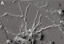 Well-Preserved Brain Cells Recovered From Victim of Vesuvius