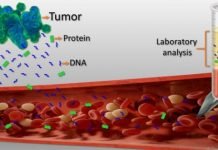 FDA Approves Liquid Biopsy Tests to Assist in Cancer Treatment