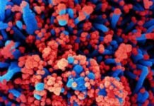 Discovered:Genetic and Immunologic Foundations For Some Cases of Severe COVID-19