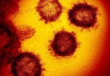 Vital: Current Hard/Real stats on US Covid and What they mean (two minute read)