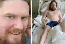 Unvaccinated man thought he was ‘in a low-risk situation’ – then he lost his leg to COVID-19