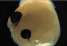 Mini Brains Grown From Stem Cells Develop Eye-Like Features