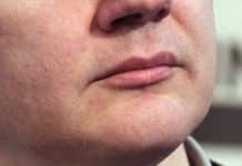 Incautious Indiscretions