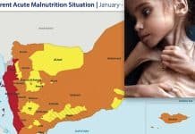 Worse than Ukraine! In Yemen “Catastrophic” Hunger due to Saudi War, 400,000 Toddlers at “Risk of Death”